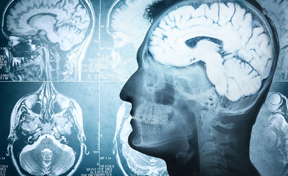 Certificate in Brain Health
